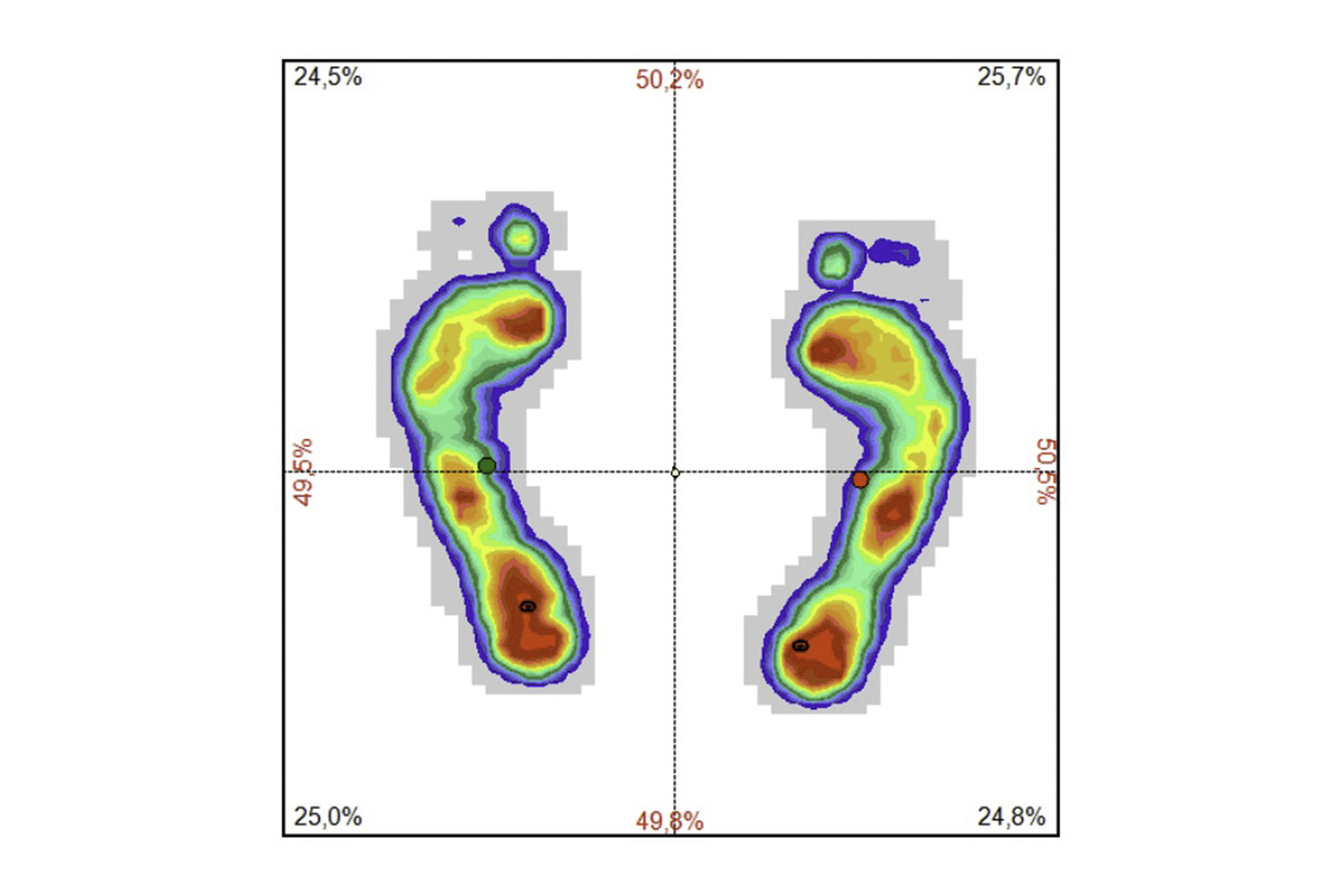 Fußdruckmessung